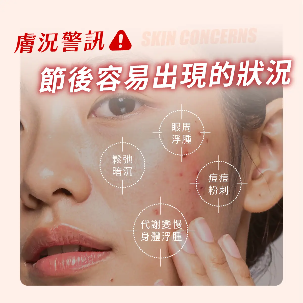 中秋美食的甜蜜陷阱:你的膚況與體態準備好了嗎?-圖3